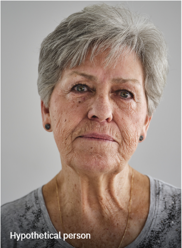 Hypothetical patient who experiences GPA relapses