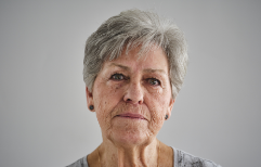 Hypothetical patient who experiences GPA relapses